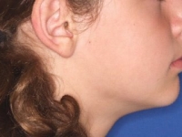 01-01--033-Right Profile-02072015