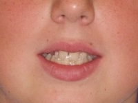 03-03--034-Frontal Smiling-01012006 (1).jpg