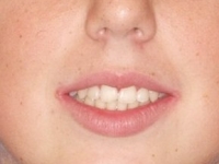 07-03--034-Frontal Smiling-24092014 (1).jpg