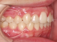 07-05--075-Right Bite-24092014.jpg