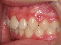 07-06--074-Left Bite-24092014.jpg