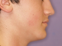 02-01-033-right-profile-16032011