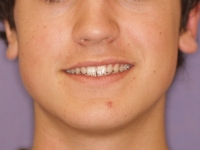 02-03-034-frontal-smiling-16032011