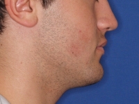 06-01-033-right-profile-01012006