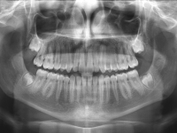 00-01-173-panoramic-xray-16032011