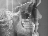 05-02-170-lateral-xray-15012013