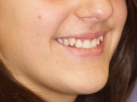 01-03-034-frontal-smiling-24022010