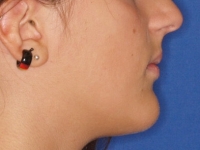 04-01-033-right-profile-01012006