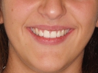 04-03-034-frontal-smiling-01012006