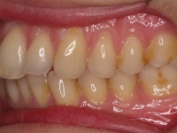 01-06--074-Left Bite-01012006.jpg