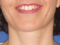 03-03--034-Frontal Smiling-23092015