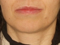 09-02--031-Frontal-20022018