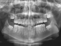 12-01-173-panoramic-xray-24062013
