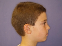 01-01--033-Right Profile-18062008