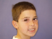 01-03--034-Frontal Smiling-18062008