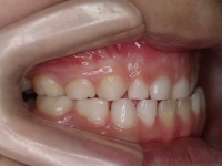 01-05--075-Right Bite-18062008