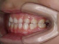 01-06--074-Left Bite-18062008