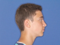 14-01--033-Right Profile-02072015