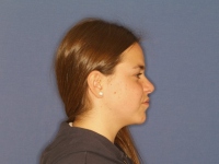 14-01-Imagen-12-033-Right-Profile-23052019