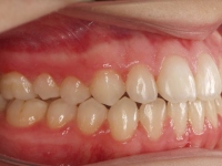 14-05-Imagen-16-075-Right-Bite-23052019